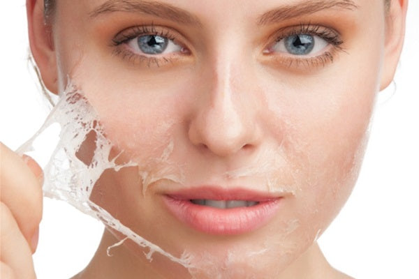 What is the best acid for skin peel?
